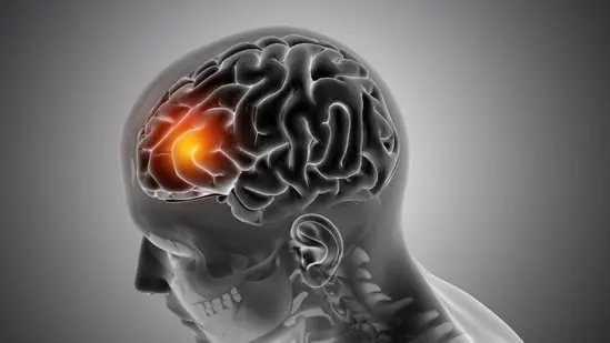 Alzheimer's disease is caused by the abnormal buildup of proteins in and around brain cells.