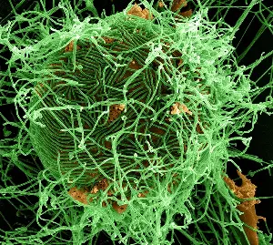 Bundibugyo Ebola vaccines, treatments in development 