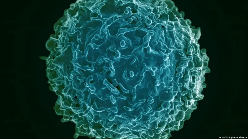 Terapia que parecía imposible logra tratar tres enfermedades autoinmunes en una paciente