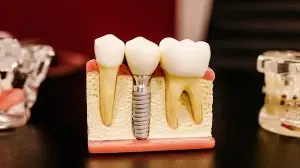 Dentists reveal early signs your teeth show about hidden health issues