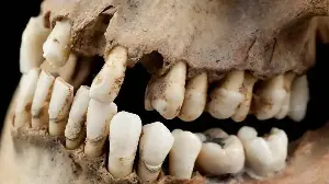 From Ashes to Urine: The Disturbing Truth About Toothpaste in Ancient Societies