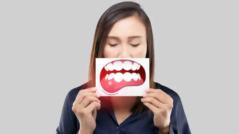 A woman with oral cancer