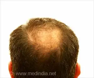 Fact Check: Can Hair Growth Gadgets Really Stop Hair Loss?