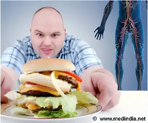 High-Fat Diets and Brain Health: Unveiling the Gut-Bacteria Pathway