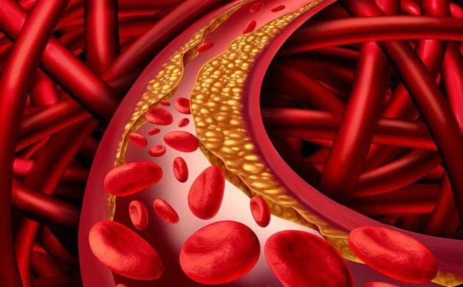 Giảm cholesterol bằng thực dưỡng: Chìa khóa bền vững bảo vệ tim mạch từ bữa ăn hằng ngày- Ảnh 1.