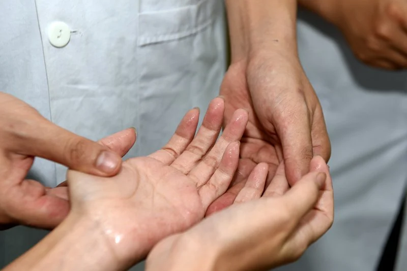 Giải pháp hỗ trợ điều trị giảm đổ mồ hôi tay hiệu quả- Ảnh 2.