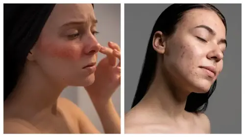 Over-exfoliation results in irritated redness, while under-exfoliation causes dull and uneven skin tone.
