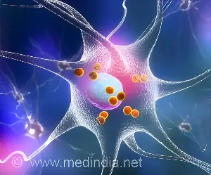 How Multiple Sclerosis Disrupts Work, Social Life and Finances