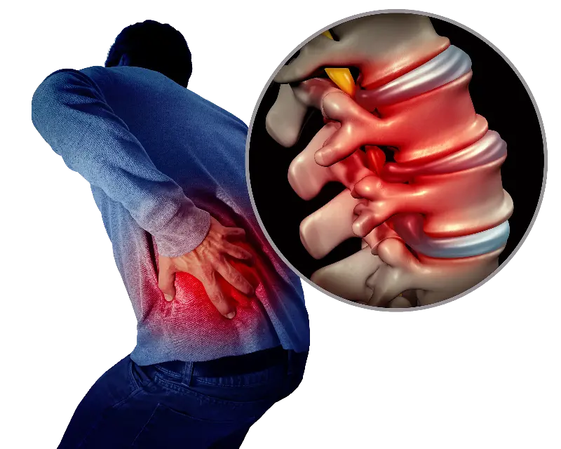 man holding lower back showing sciatica nerve pain caused by compressed spinal disc