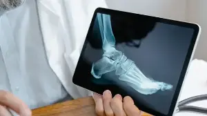 Persistent bone pain? Oncologist Dr Saurabh Gupta shares the early signs of bone cancer that shouldn't be ignored