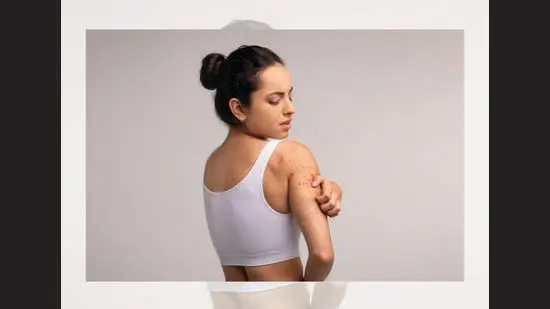 Babe, wake up, a new beauty flaw just dropped. It’s called strawberry skin (or rough patches). (SHUTTERSTOCK)