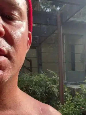 Channing Tatum issues update on shoulder injury: 'This has been the lowest of the lows'