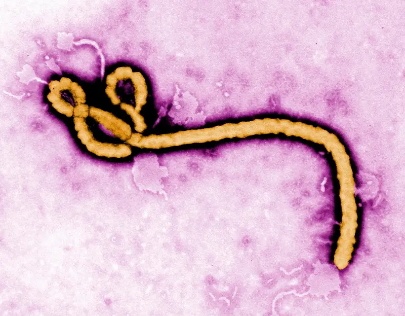 A transmission electron micrograph image shared by the CDC shows an Ebola virus virion. 