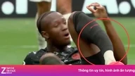 The horrific injury suffered by the Canadian star.