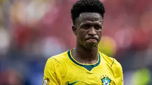 Photo: Like a different person! Vinicius's features transformed after undergoing cosmetic surgery