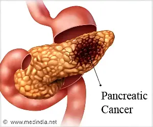 Lowering a Blood-Clotting Protein may Slow Pancreatic Cancer