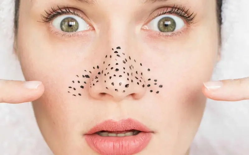 5 daily skincare steps for smooth skin - Photo 2.