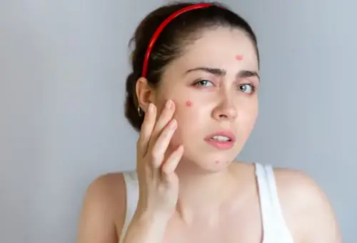Use a cleanser containing salicylic acid to help control oil production. (Freepik)