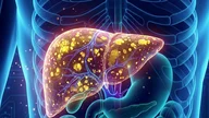 Why do many people lose weight but their liver fat doesn't decrease?