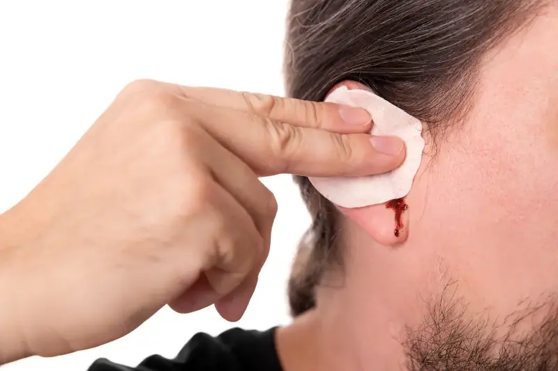 Head to doctor when the piercing starts to look serious, from bleeding to abnormal puss.