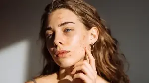 Why does your acne keep coming back? Dermatologist lists 5 daily triggers, from dirty pillowcase to unclean phone