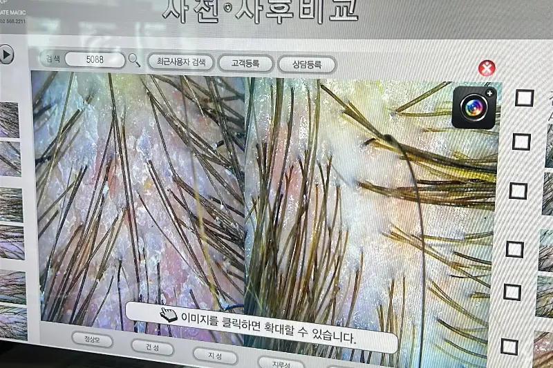 Hayley had her scalp health analysed on a trip to South Korea (Hayley Spencer)