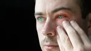 Red, watery eyes during monsoon? Ophthalmologist shares 5 common infections you should watch out for