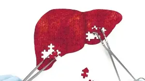 Blood tests as crucial to hepatitis elimination